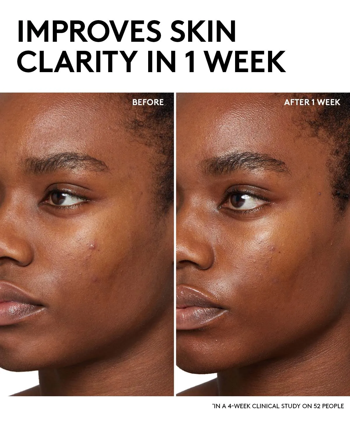 Cherry Dub BHA Toner with Salicylic Acid   Aloe Juice