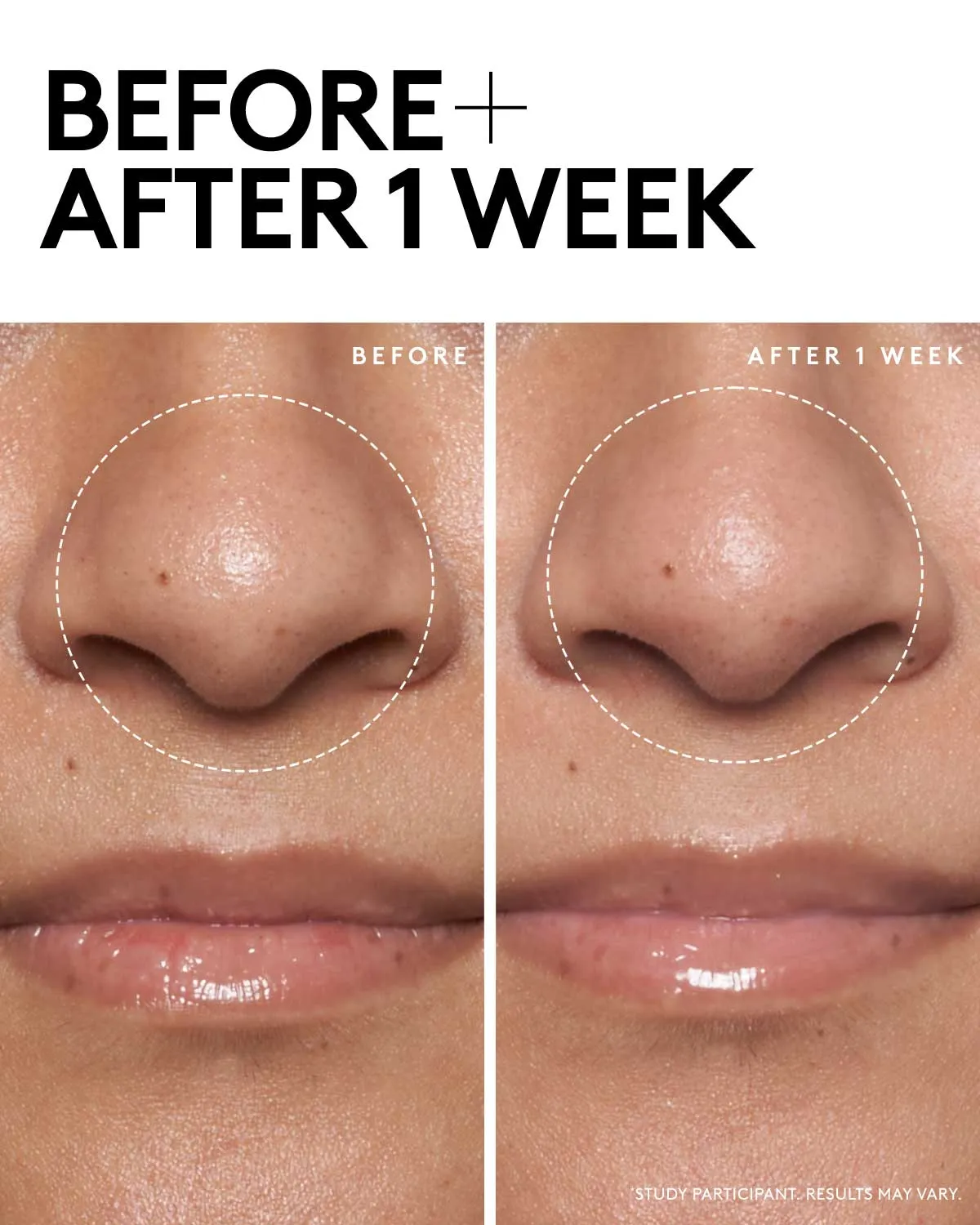 Detox N Tone Shine-Fighting Duo